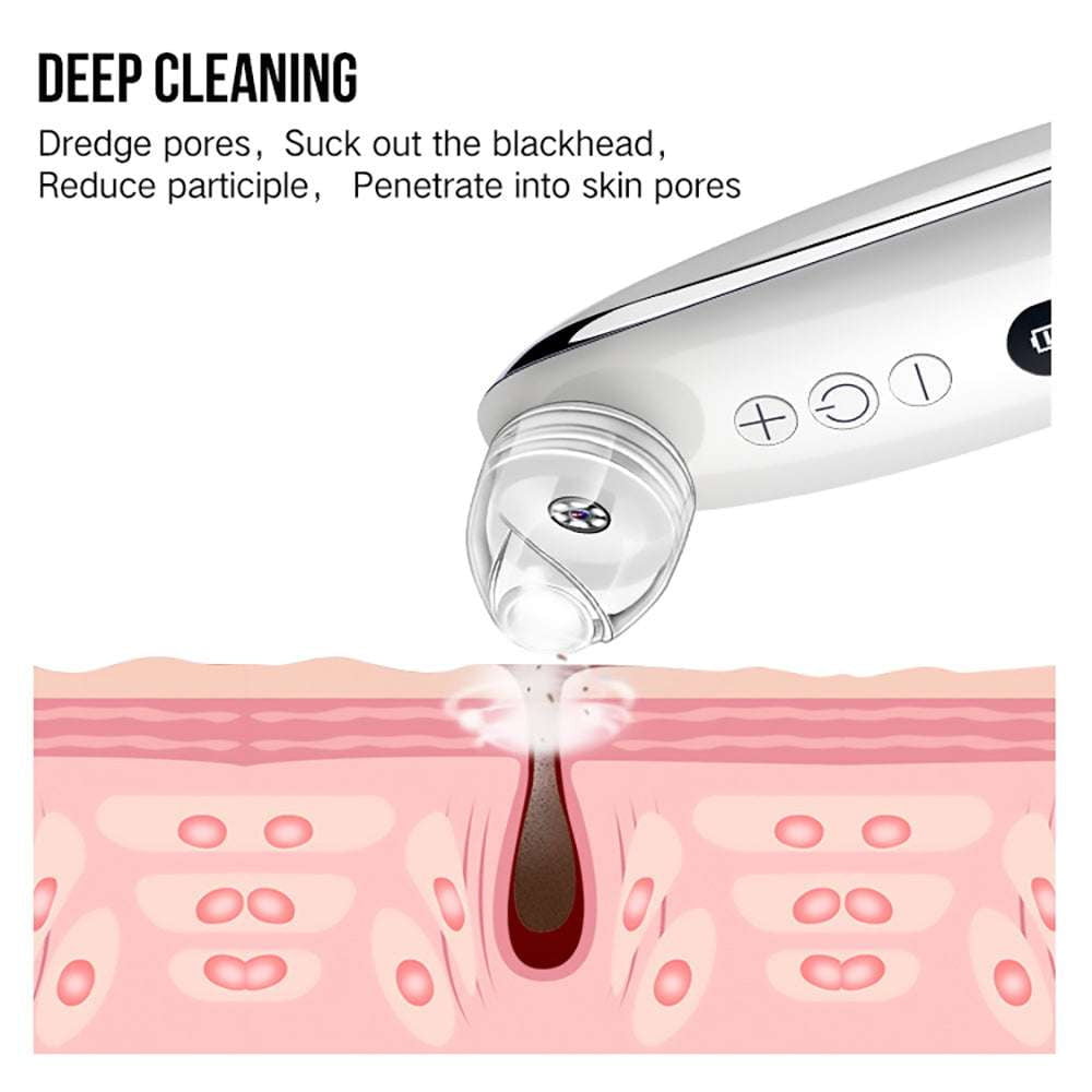 Blackhead Remover Camera, Effective Blackhead Remover, Facial Blackhead Remover - available at Sparq Mart