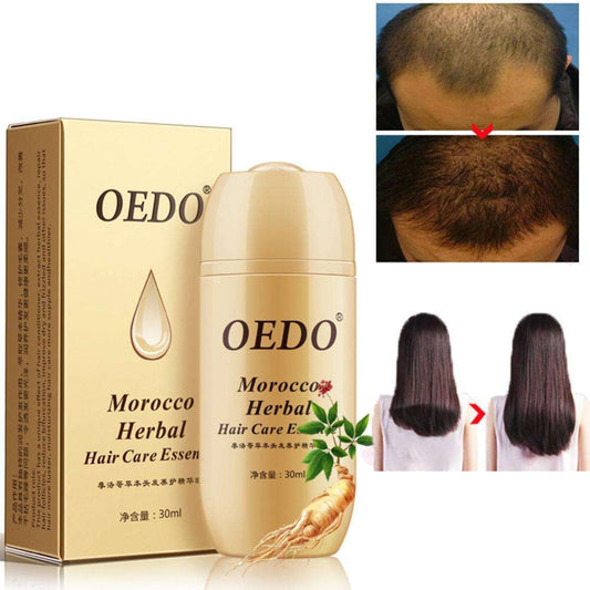 Herbal Hair Growth Serum, Moroccan Hair Repair Oil, Natural Hair Shine Serum - available at Sparq Mart